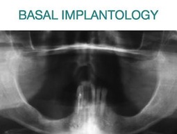 basal_implantology
