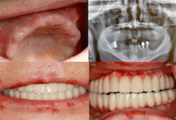 before_after_255